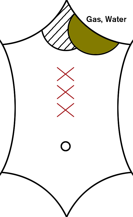 Ban Xia Hou Po Tang Kingston Acupuncture, Acupuncturist Kingston, NY